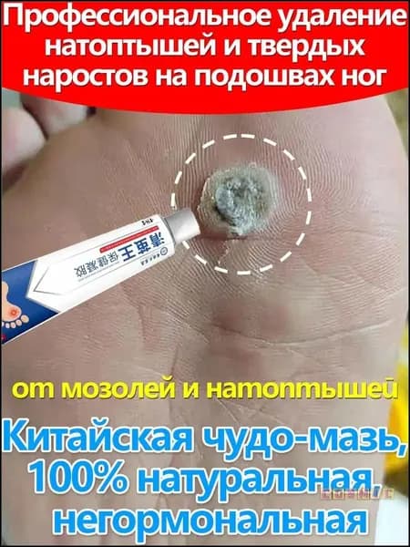 Мозоли на пальцах ног, натоптыши, боль при ходьбе/вальгусная деформация стельки, шишки,20 г