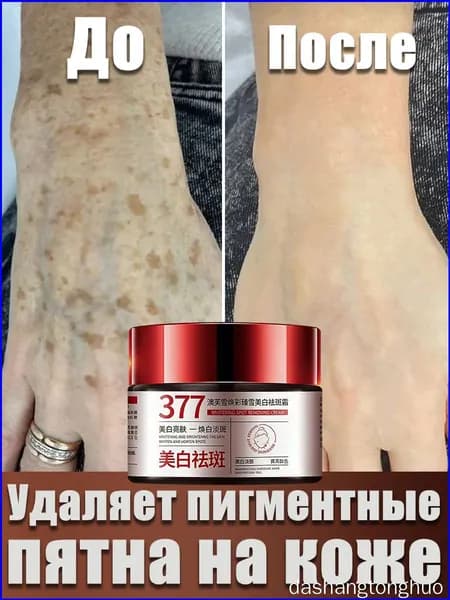 Крем от пигментации для лица 30 г эффективно удаляет веснушки,пигментные пятна солнечные ожоги,старческие пятна,восстанавливает кожу,осветляет тон кожи
