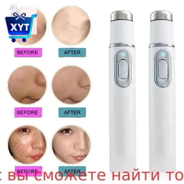 Лазерная ручка для удаления акне, массажер глаз, инструмент украшения