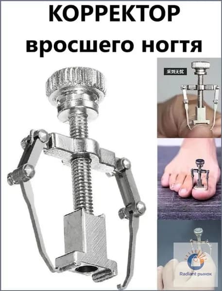 Корректор фиксатор вросшего ногтя