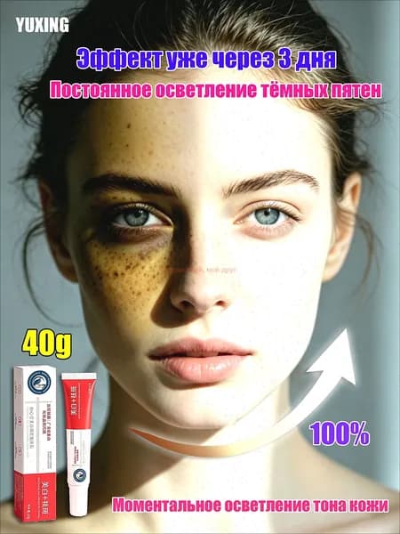 YUXING Крем для осветления веснушек, пигмента и темных кругов под глазами 20г 2 шт