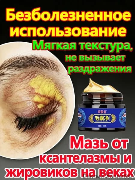 Мазь от ксантелазмы и жировиков на веках