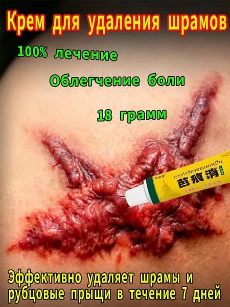 крем от шрамов и рубцов, Подходит для гипертрофических рубцов, рубцов от угрей и ожогов, способствует заживлению и исчезновению. Можно использовать на лице и теле, 18 г