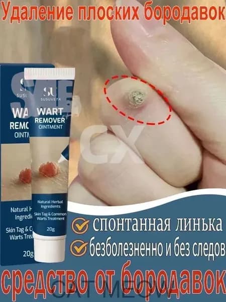 Средство от папиллом и бородавок(Совершенно новая версия ), для удаления бородавок папиллом, сухих мозолей на ногах и теле, мазь для ухода за кожей, безболезненно, не оставляет следов 20 г
