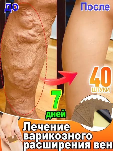 пластырь от варикоза на ногах,патчи от отеков,патчи для ногг,40 шт.