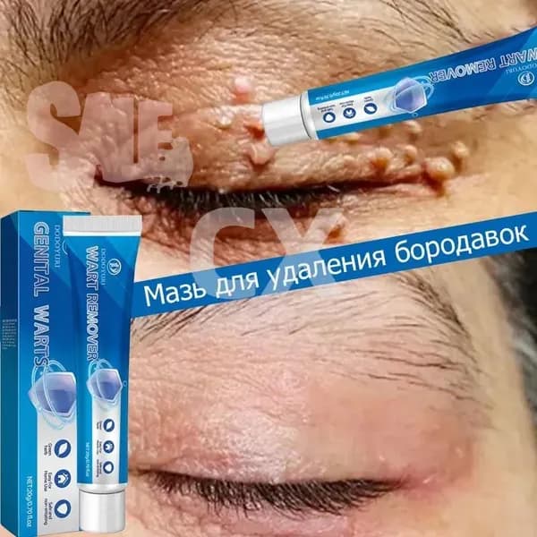 Карандаши для удаления бородавок MR&MISS для лечения бородавок, папиллом и родинок без боли и следов. Без побочных эффектов / 30 г