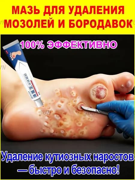 Мазь для быстрого удаления мозолей и бородавок, видимый результат за 5-7 дней, восстанавливает кожу, 20г