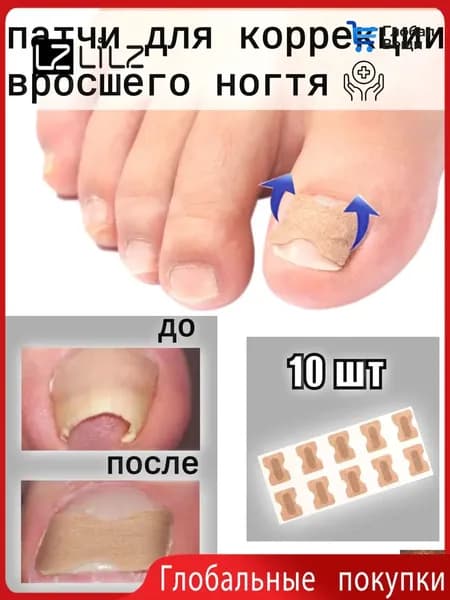 Пластыри для коррекции вросших ногтей на пальцах ног, 10 штук-LZ