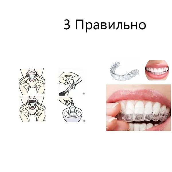 Антихраповая каппа: защита от бруксизма и скрежета зубами во время сна