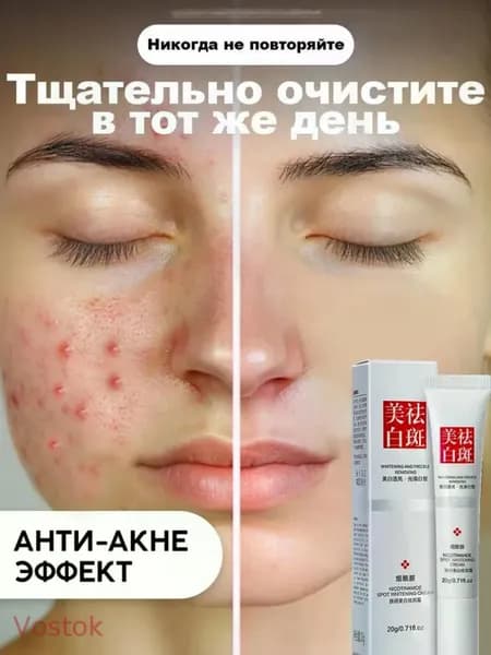 Точечный крем от прыщей,Восстановление лица, угри, угревая сыпь, сыпь будут стерты начистоЧистый растительный экстракт без раздражения, подходит для мужского и женского типов кожи, 20 г