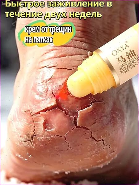 Крем воск от трещин для очень сухой кожи, крем для ног с мочевиной 5%, от трещин на пятках, воск для пяток