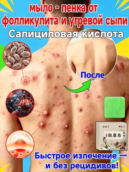 Твердое мыло