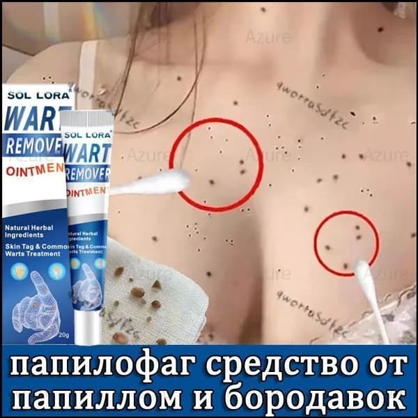Средство от бородавок, папиллом и кондилом 20 г