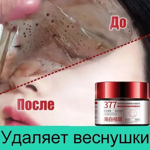Крем для лица от Веснушек и Пигментных пятен 30г против пигментации, отбеливающий для лица увлажняющий, Содержит гиалуроновую кислоту и 377.