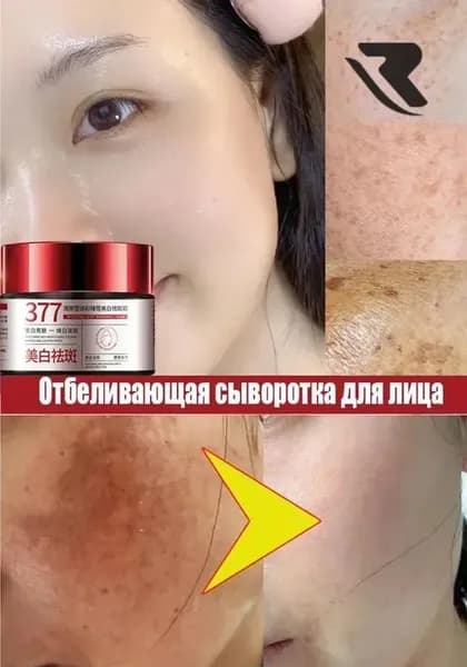 отбеливающий крем 377, уменьшает пигментацию, уменьшает темные пятна, глубоко увлажняет и эффективно борется с пигментацией