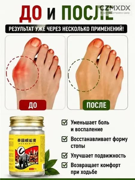 Мазь при вальгусной деформации косточки обезболивающая 55 г
