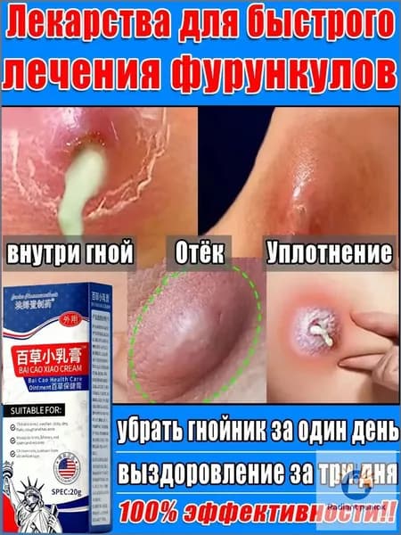 Вытягивающая мазь от фурункулов, чирей, акне и гнойников как Вишневского 20г