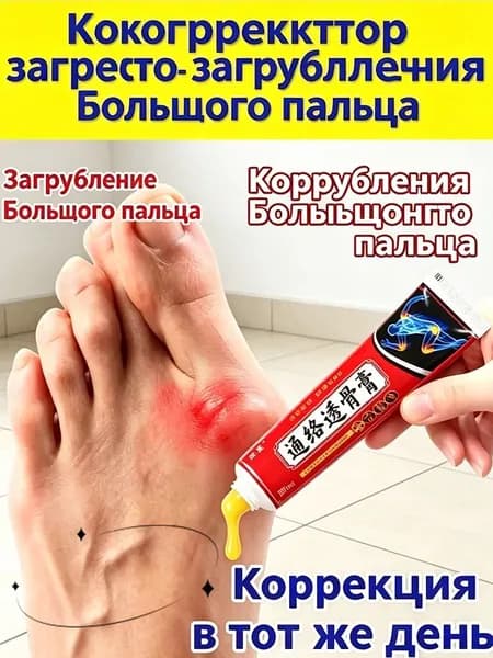 Вальгусная деформация большого пальца стопы