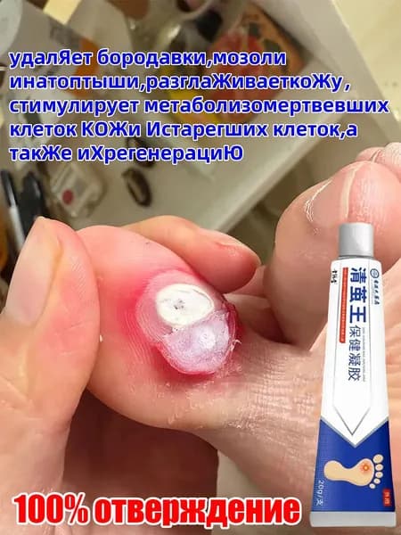 Средство от мозолей и натоптышей на ногах .Косметическое средство для стоп от мозолей, натоптышей и трещин.китайская чудо-мазь 20 г