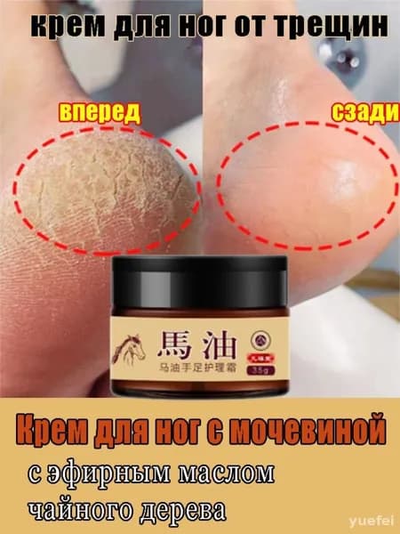 Крем для ног с мочевиной 30%, от трещин и натоптышей, ультра увлажняющий питательный крем, уход для стоп, 35 мл