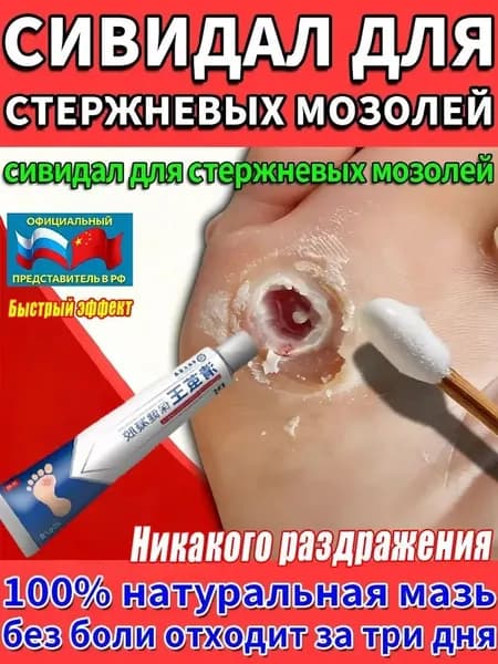 Эксклюзивный китайский гель и мазь Корнекс для удаления шипиц, натоптышей и стержневых мозолей, эффективное средство в двух тюбиках