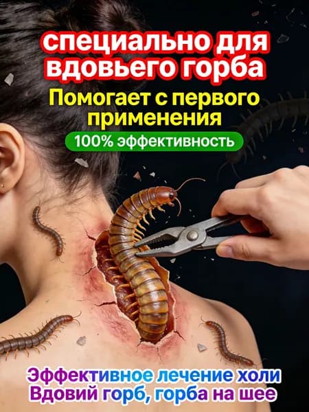 Эксклюзивная мазь от шейного остеохондроза и вдовьего горба, созданная на 100 из натуральных,сделано в Китае
