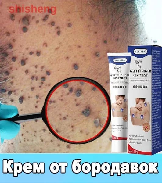 Профессиональный крем для удаления бородавок 20г, эффективен против вульгарных бородавок, папиллом и кератом, бережное удаление без повреждения здоровой кожи