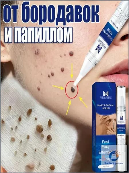 MR&MISS карандаш от папиллом и бородавок 3 мл, папиллом и родинок без боли и следов. Без побочных эффектов