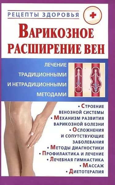 Варикозное расширение вен. Лечение традиционными и нетрадиционными методами | Горбунов Виктор Владимирович | Электронная книга
