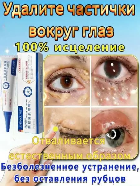 Крем премиум для ухода за кожей,Используется для удаления частичек вокруг глаз, которые естественным образом отпадают, не оставляя шрамов