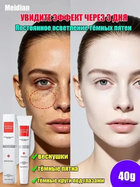 MEIDIAN Крем для отбеливания веснушек, осветление пигментных пятен, меланодермия, подбитый глаз 20g 2 шт