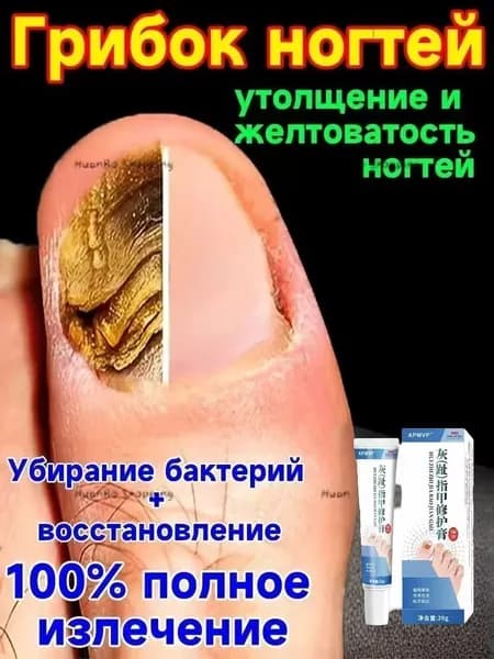 мазь ноготок от грибка ногтей на ногах,Лечите грибковые инфекции, укрепляйте и восстанавливайте ногти и роговой слой кожи, а также устраняйте грибок ногтей на ногах.