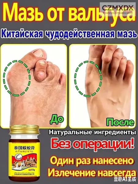 Крем при вальгусной деформации, от шишек на больших пальцах ног, Боль в суставах, подагра20 г