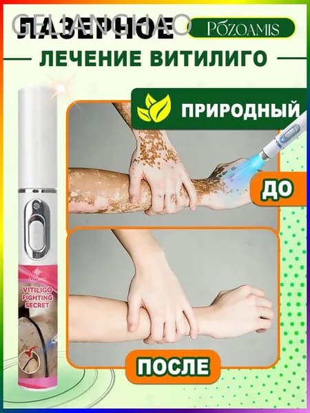 Лазерная ручка, разработанная специально для витилиго, точно осветляет белые пятна и выравнивает тон кожи. Без боли всего один стик поможет вернуть чистой, ровной и сияющей здоровой коже.
