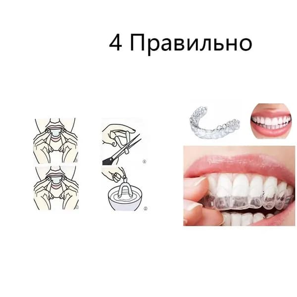 Антихраповая каппа: защита от бруксизма и скрежета зубами во время сна