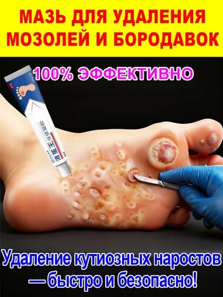Мазь для быстрого удаления мозолей и бородавок, видимый результат за 5-7 дней, восстанавливает кожу, 20г