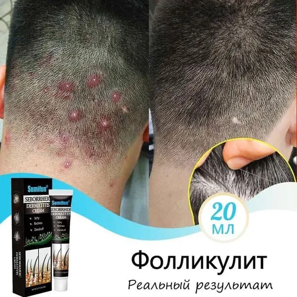 Средство для лечения кожи головы и волос