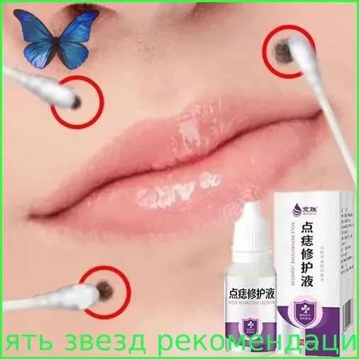 Крем для удаления родинок 10 мл от пятен черных родинок и бородавокВосстанавливает огрубевшую кожу