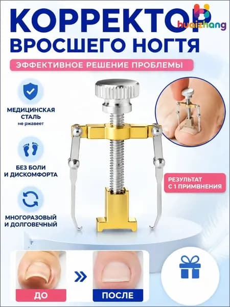 Коррекция вросших ногтей