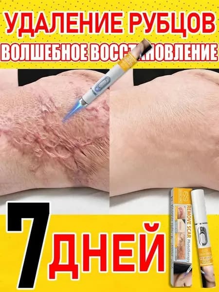 Лазерная ручка для удаления шрамов, удаляет шрамы, родинки, ожоги, растяжки, следы ожирения, лечит послеоперационные шрамы, предотвращает образование рубцов, восстанавливает кожу.1 упаковка