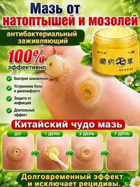 салипод от стержневых мозолей,мазь от натоптышей и на ногах