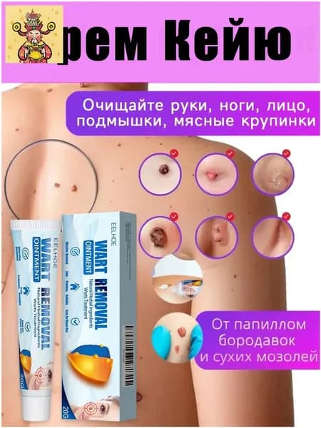 Средство от папиллом и бородавок, мазь для ухода за кожей, крем от родинок, Натуральные растительные ингредиенты 20г