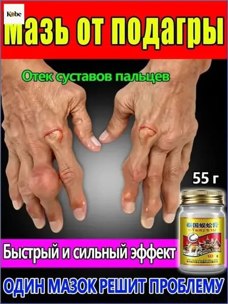 Мазь от подагры и артрита - Обезболивающая для суставов, коленей, пальцев ног