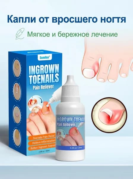 20ML Капли для смягчения ногтей на ногах, подходят для лечения паронихии