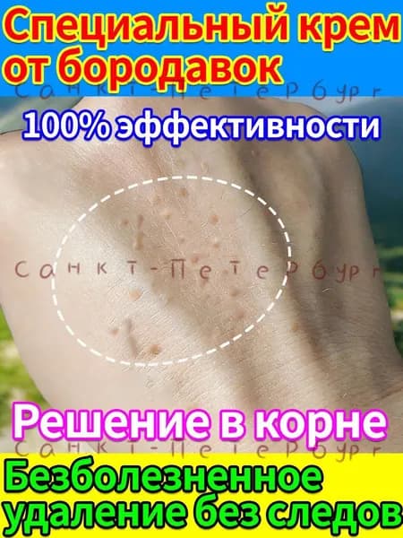 Безболезненное удаление плоских бородавок, папиллом, нитевидных и остроконечных кондилом без шрамов