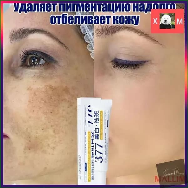 Премиумсостав с гиалуроновой кислотой и витаминами Е, С применяется для осветления веснушек, увлажнения и коррекции пигментных пятен, 30 г Yy3