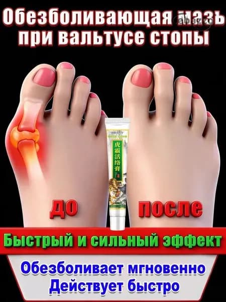 Гель от косточки на ноге, снимает боль и воспаление, выравнивает палец, для дневного и ночного использования. 20 г.