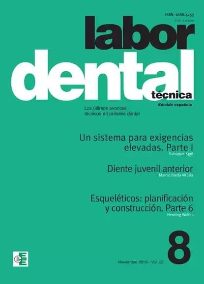 Labor Dental Tcnica Vol.22 Noviembre 2019 no8 | Электронная книга