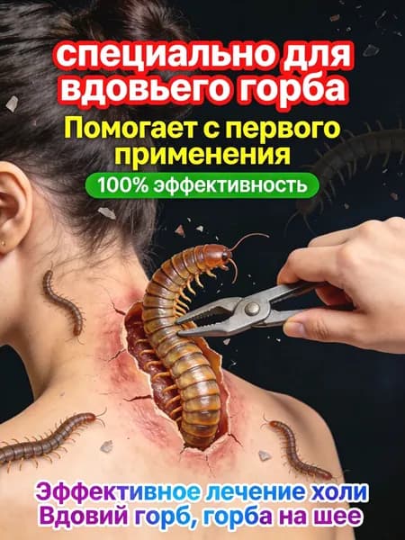 Эксклюзивная мазь от шейного остеохондроза и вдовьего горба, созданная на 100 из натуральных,сделано в Китае