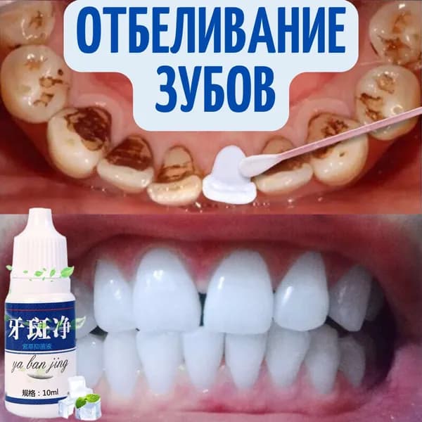 Отбеливание зубов Ya Ban Jing. Средство для чистки и отбеливания зубов в домашних условиях